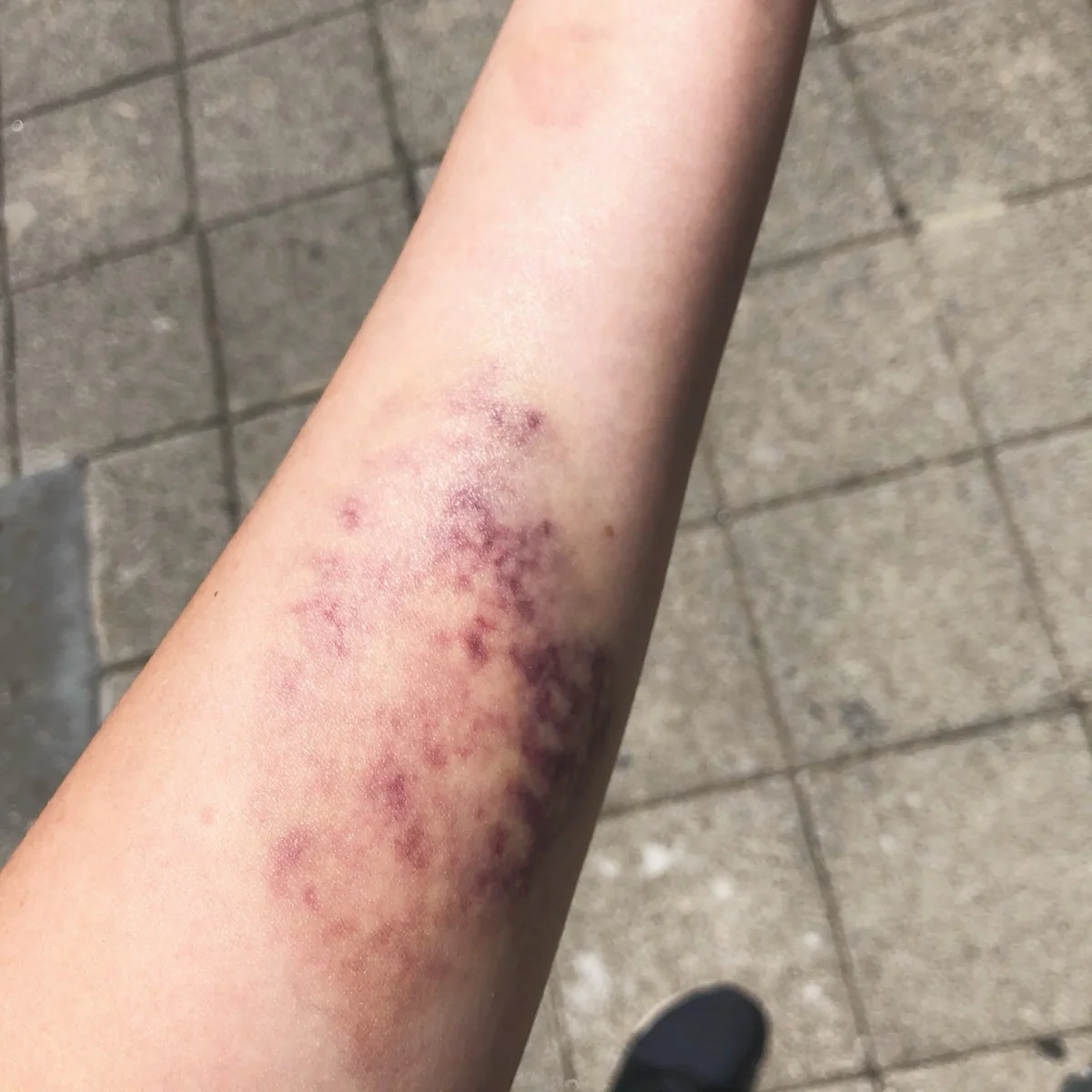 หากไม่มี Yugaeri สายธนูอาจตีโดนตัวเอง — เบาๆ ก็ช้ำที่แขน หนักๆ ก็โดนหูและใบหน้า ทำให้ผู้เริ่มต้นกลัวการปล่อยลูกศร